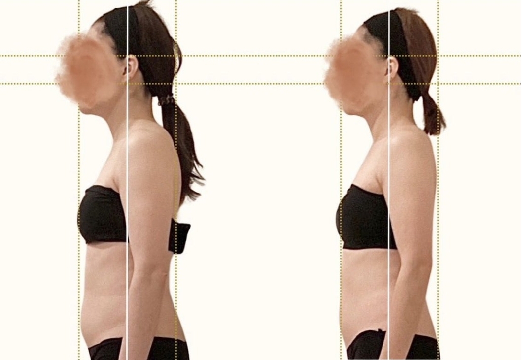 施術を受けたお客様のビフォーアフター写真