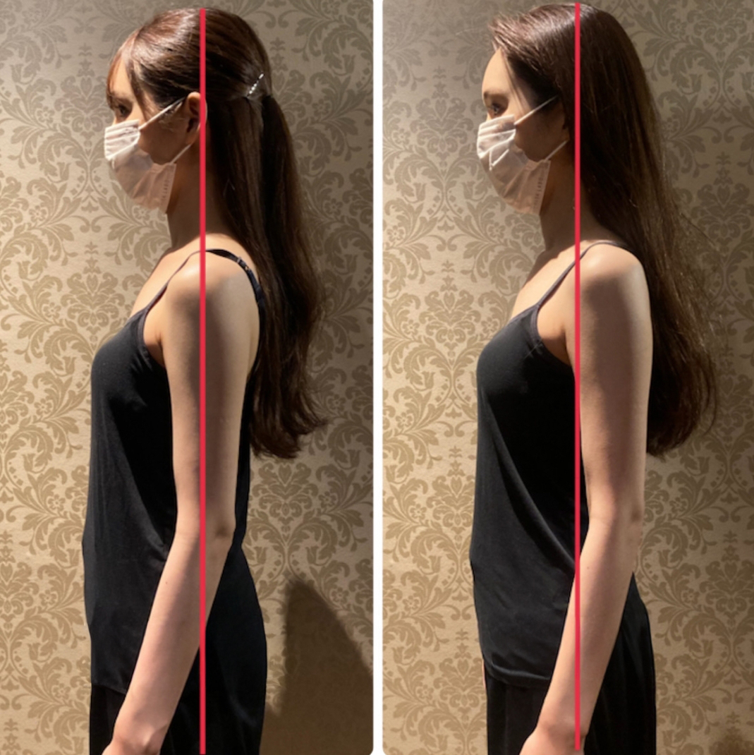 施術を受けたお客様のビフォーアフター写真